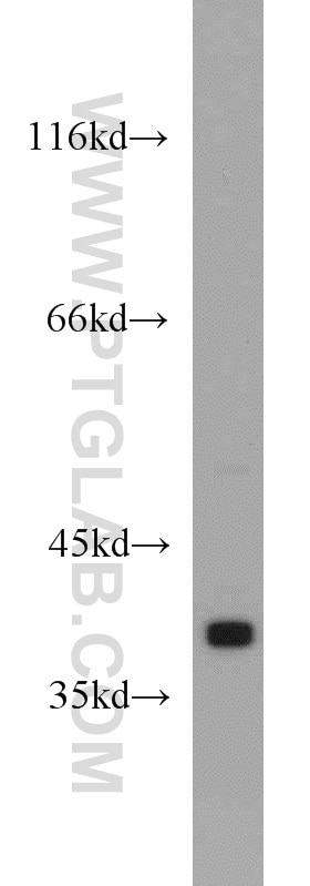 Western Blot (WB) analysis of human testis tissue using PKA C-alpha specific Polyclonal antibody (55388-1-AP)