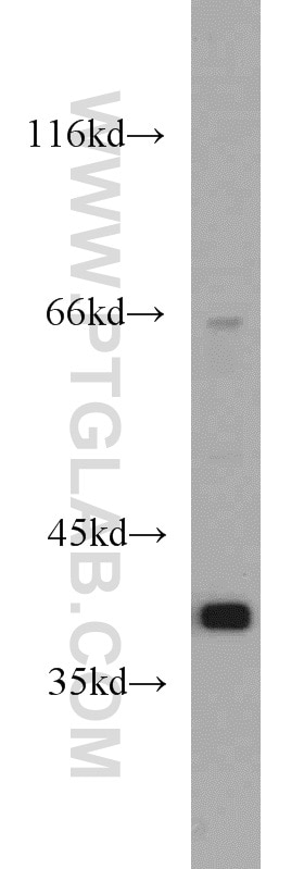 Western Blot (WB) analysis of human testis tissue using PKA C-alpha specific Polyclonal antibody (55388-1-AP)