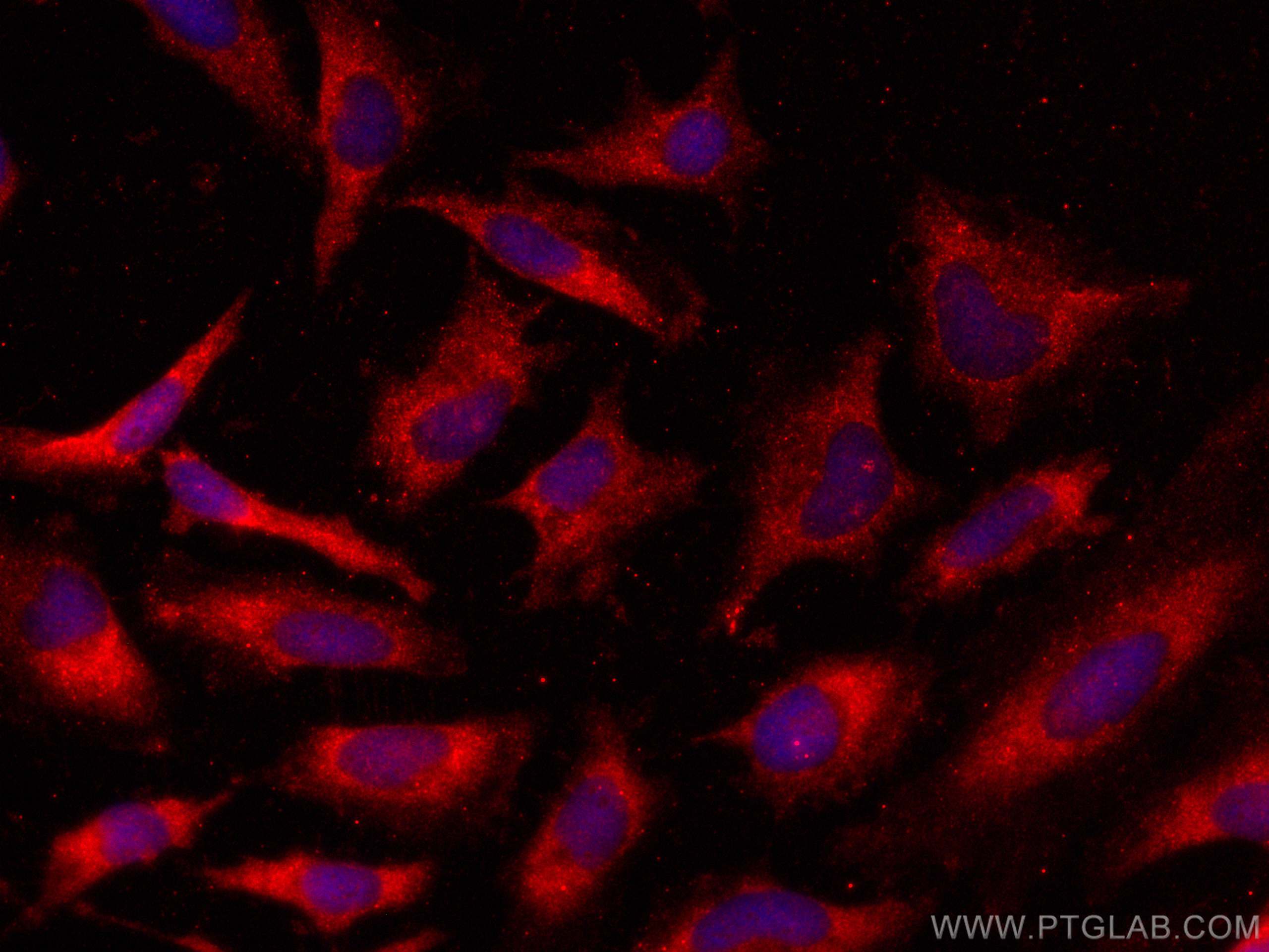 Immunofluorescence (IF) / fluorescent staining of HeLa cells using PRKACB Polyclonal antibody (12232-1-AP)