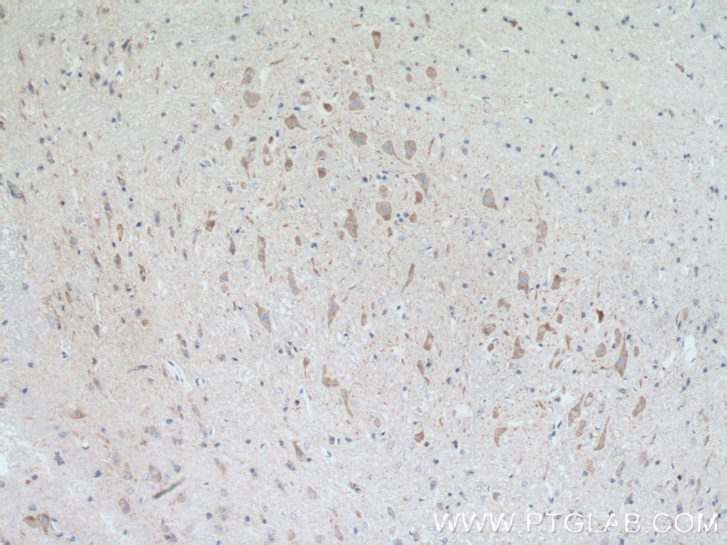 Immunohistochemistry (IHC) staining of mouse brain tissue using PRKACB Polyclonal antibody (12232-1-AP)