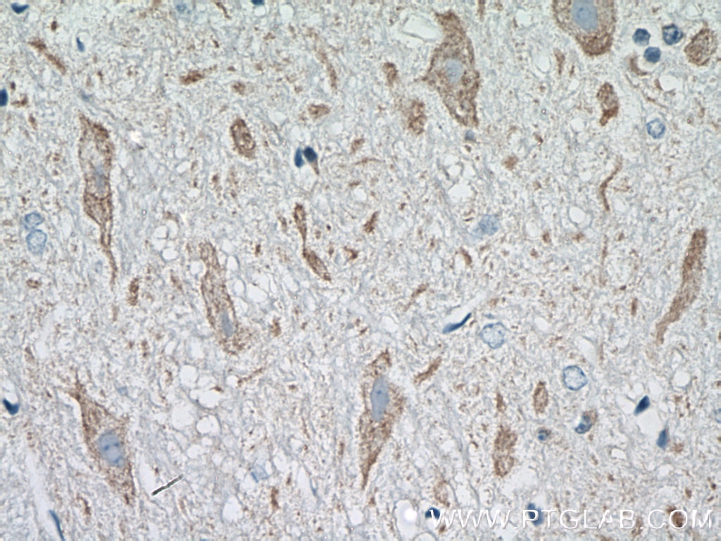 Immunohistochemistry (IHC) staining of mouse brain tissue using PRKACB Polyclonal antibody (12232-1-AP)