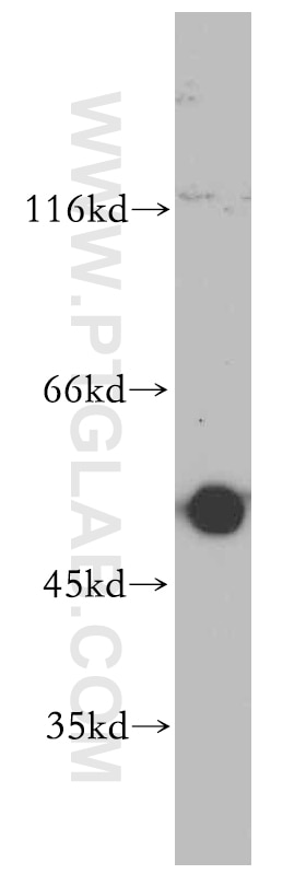 Western Blot (WB) analysis of MCF-7 cells using PRKACB Polyclonal antibody (12232-1-AP)