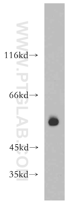 Western Blot (WB) analysis of A549 cells using PRKACB Polyclonal antibody (12232-1-AP)