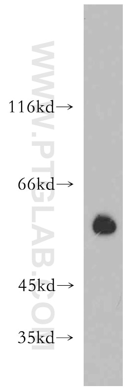 Western Blot (WB) analysis of PC-3 cells using PRKACB Polyclonal antibody (12232-1-AP)