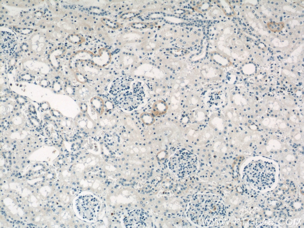 Immunohistochemistry (IHC) staining of human kidney tissue using PRKACB Polyclonal antibody (55382-1-AP)