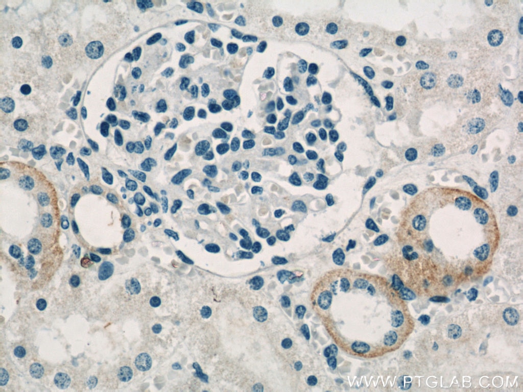 Immunohistochemistry (IHC) staining of human kidney tissue using PRKACB Polyclonal antibody (55382-1-AP)