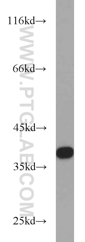 Western Blot (WB) analysis of human brain tissue using PRKACB Polyclonal antibody (55382-1-AP)