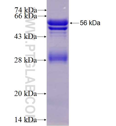 PRKACB fusion protein Ag2870 SDS-PAGE