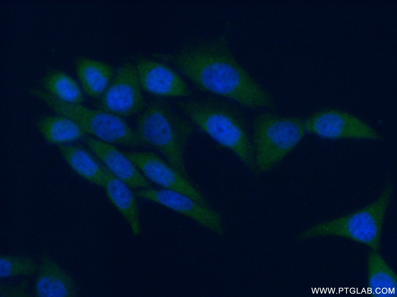 Immunofluorescence (IF) / fluorescent staining of HeLa cells using AMPK Gamma 1 Polyclonal antibody (10290-1-AP)