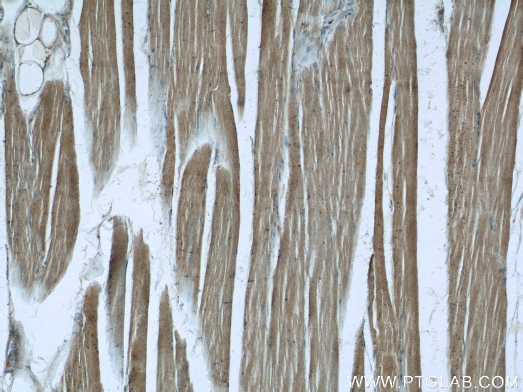 Immunohistochemistry (IHC) staining of human skeletal muscle tissue using AMPK Gamma 1 Polyclonal antibody (10290-1-AP)