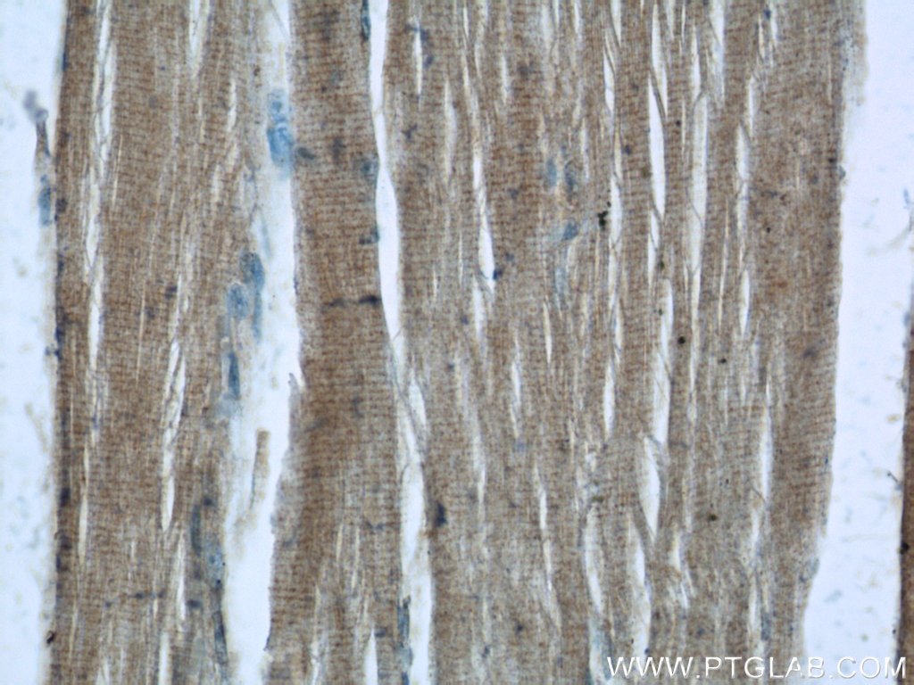 Immunohistochemistry (IHC) staining of human skeletal muscle tissue using AMPK Gamma 1 Polyclonal antibody (10290-1-AP)