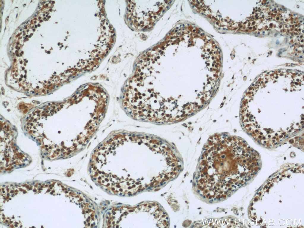 IHC staining of human testis using 10290-1-AP