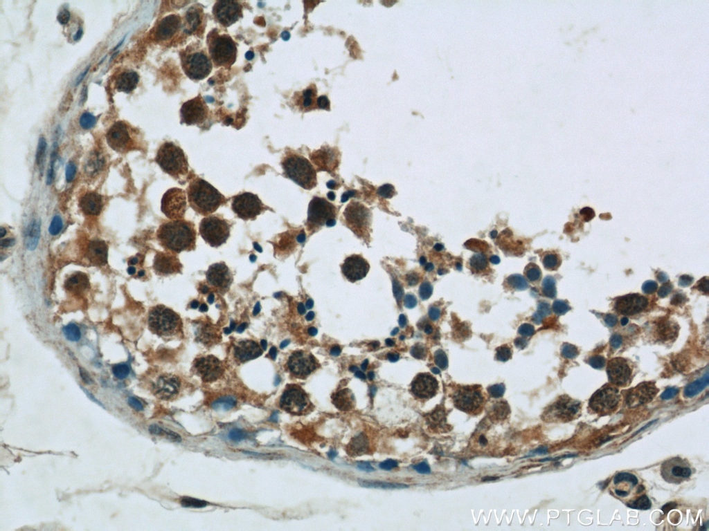 Immunohistochemistry (IHC) staining of human testis tissue using AMPK Gamma 1 Polyclonal antibody (10290-1-AP)