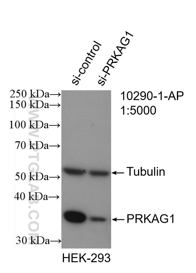 Western Blot (WB) analysis of HEK-293 cells using AMPK Gamma 1 Polyclonal antibody (10290-1-AP)