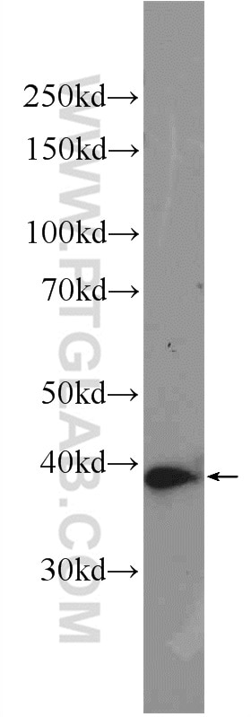 AMPK Gamma 1 Polyclonal antibody
