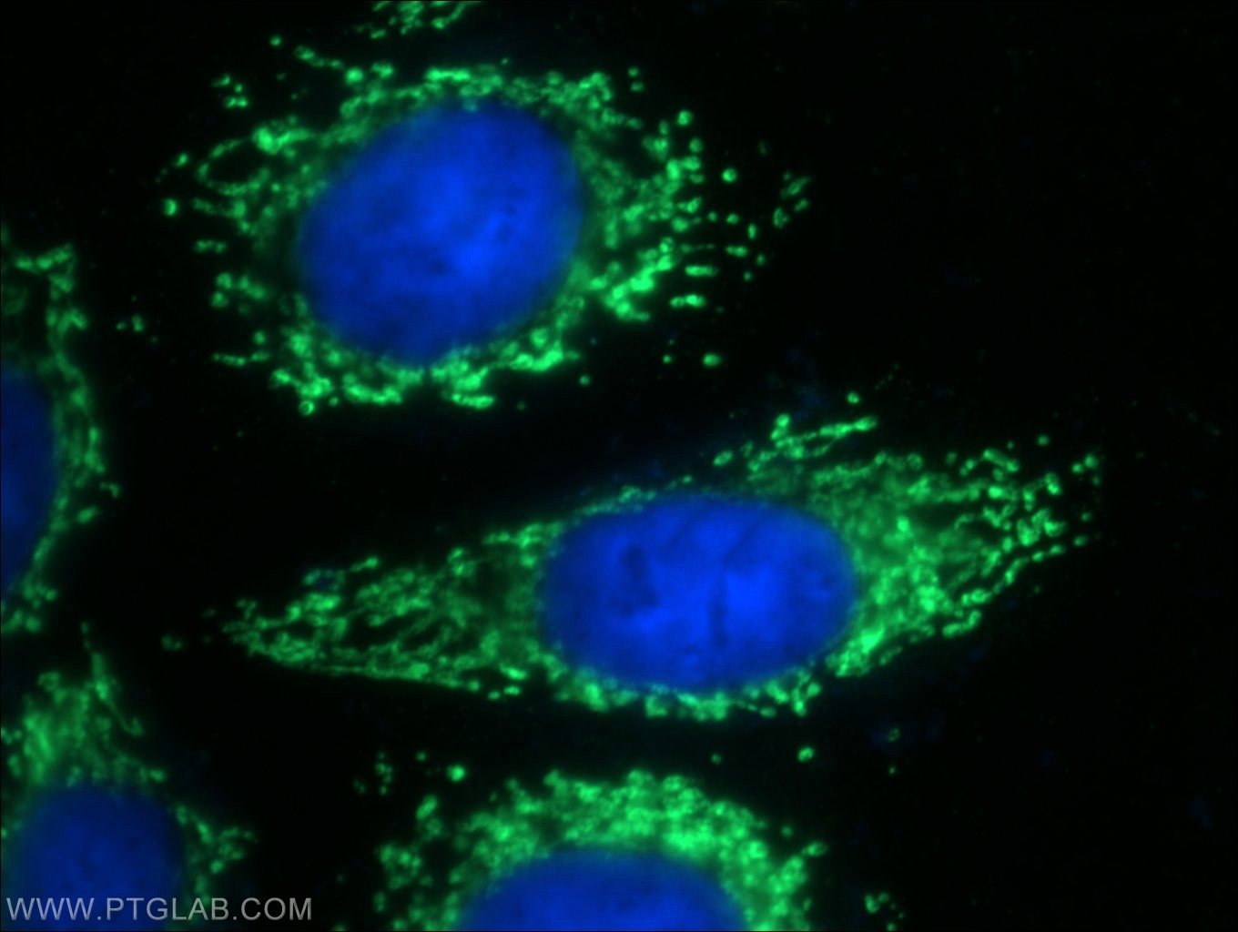 Immunofluorescence (IF) / fluorescent staining of HeLa cells using AMPK Gamma 2 Polyclonal antibody (12568-1-AP)