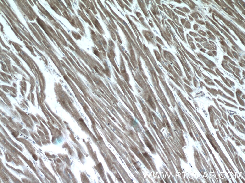 Immunohistochemistry (IHC) staining of human heart tissue using AMPK Gamma 2 Polyclonal antibody (12568-1-AP)