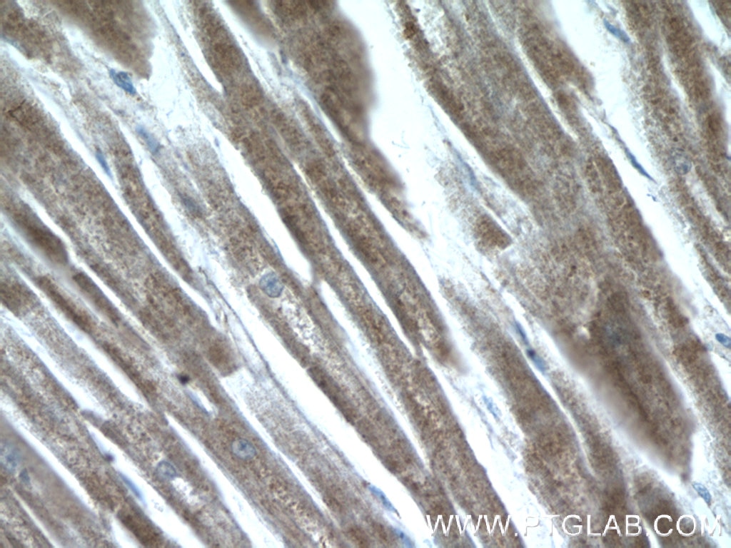 IHC staining of human heart using 12568-1-AP