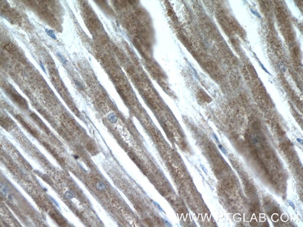 Immunohistochemistry (IHC) staining of human heart tissue using AMPK Gamma 2 Polyclonal antibody (12568-1-AP)