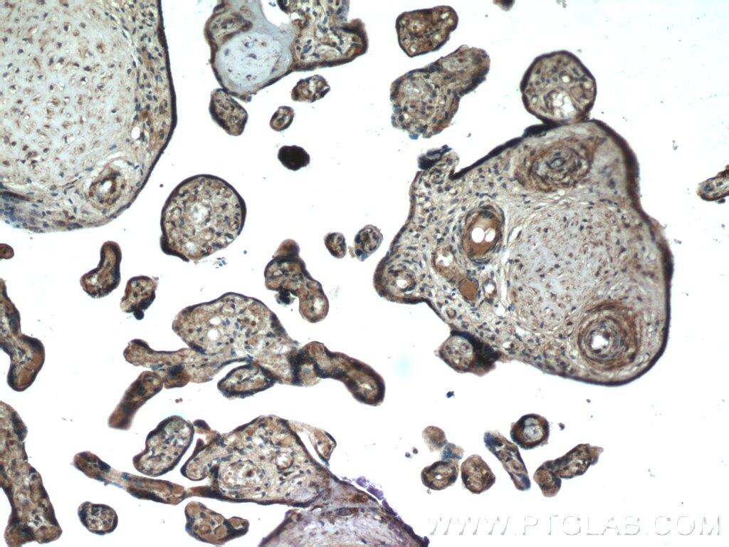 Immunohistochemistry (IHC) staining of human placenta tissue using AMPK Gamma 2 Polyclonal antibody (12568-1-AP)