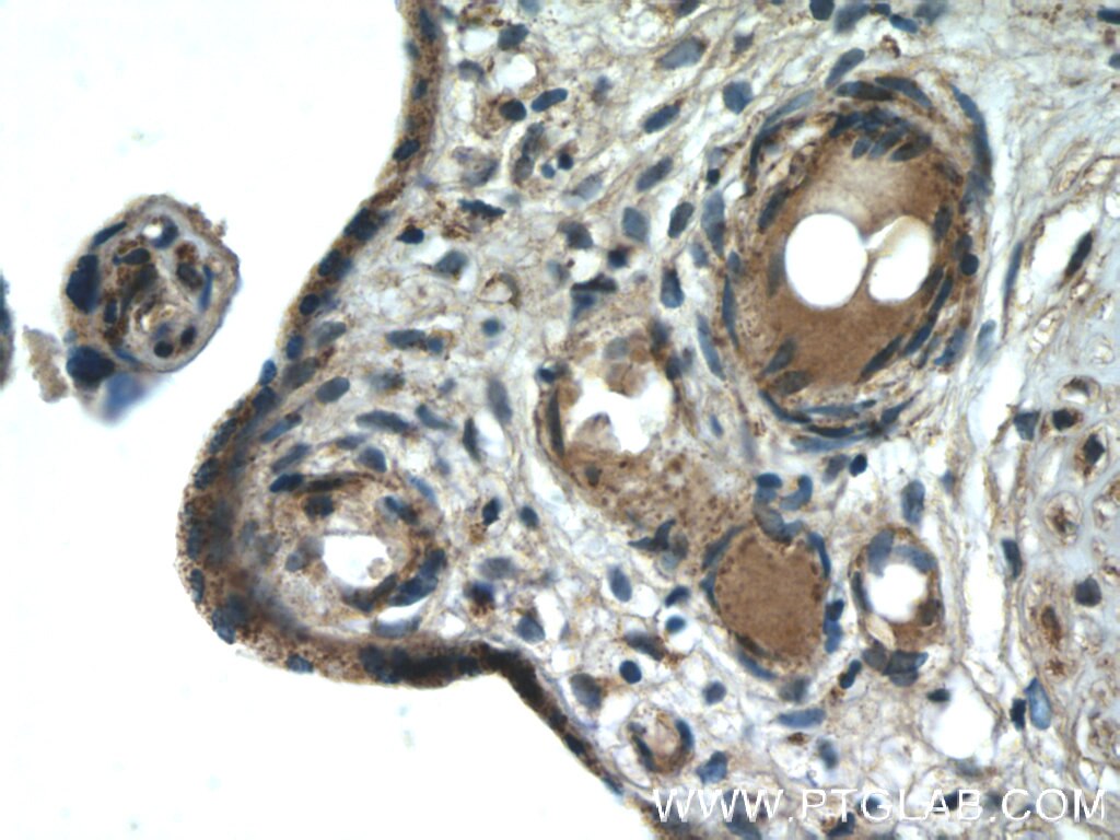 Immunohistochemistry (IHC) staining of human placenta tissue using AMPK Gamma 2 Polyclonal antibody (12568-1-AP)