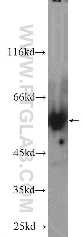 Western Blot (WB) analysis of HeLa cells using AMPK Gamma 2 Polyclonal antibody (12568-1-AP)