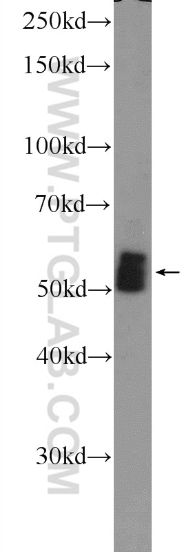 Western Blot (WB) analysis of mouse heart tissue using AMPK Gamma 2 Polyclonal antibody (12568-1-AP)