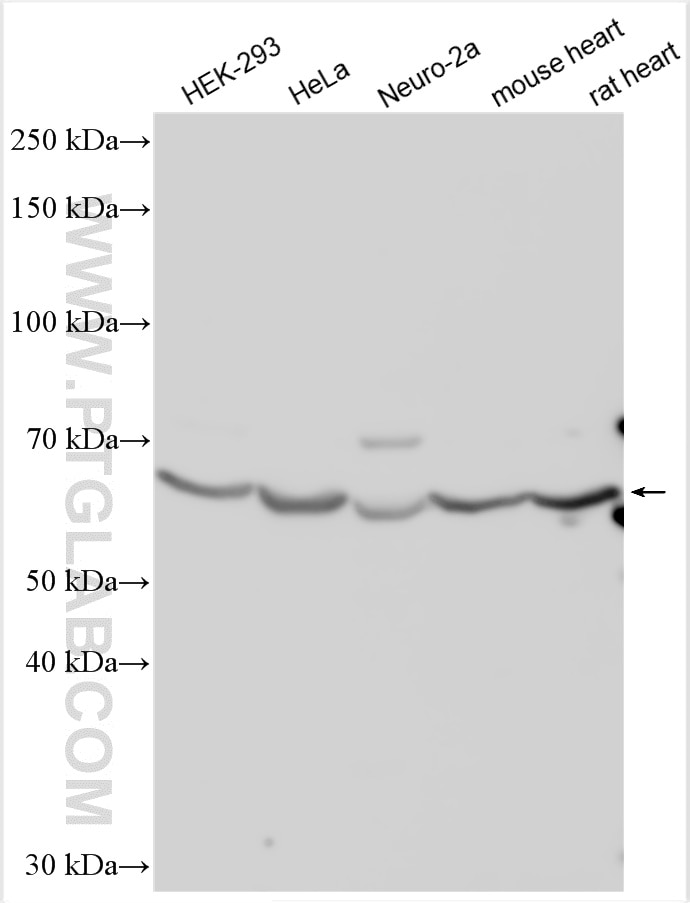 Western Blot (WB) analysis of various lysates using AMPK Gamma 2 Polyclonal antibody (12568-1-AP)