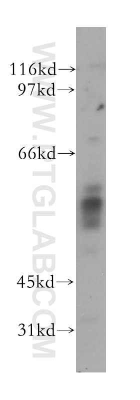 Western Blot (WB) analysis of PC-3 cells using AMPK Gamma 2 Polyclonal antibody (12568-1-AP)