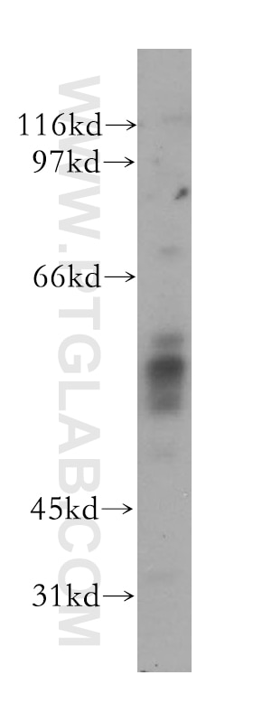 WB analysis of PC-3 using 12568-1-AP
