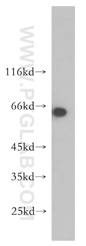 WB analysis of mouse eye using 12568-1-AP