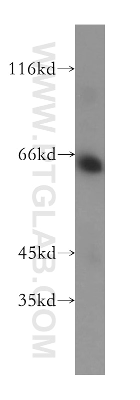 Western Blot (WB) analysis of HEK-293 cells using AMPK Gamma 2 Polyclonal antibody (12568-1-AP)