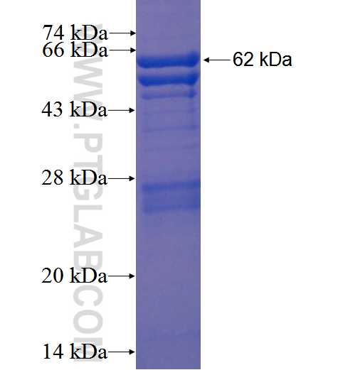 PRKAG2 fusion protein Ag3214 SDS-PAGE