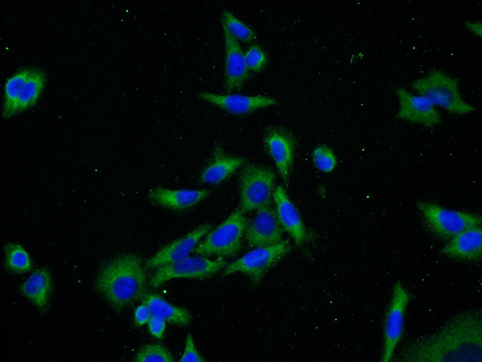 Immunofluorescence (IF) / fluorescent staining of HeLa cells using PRKAR1A Polyclonal antibody (20358-1-AP)