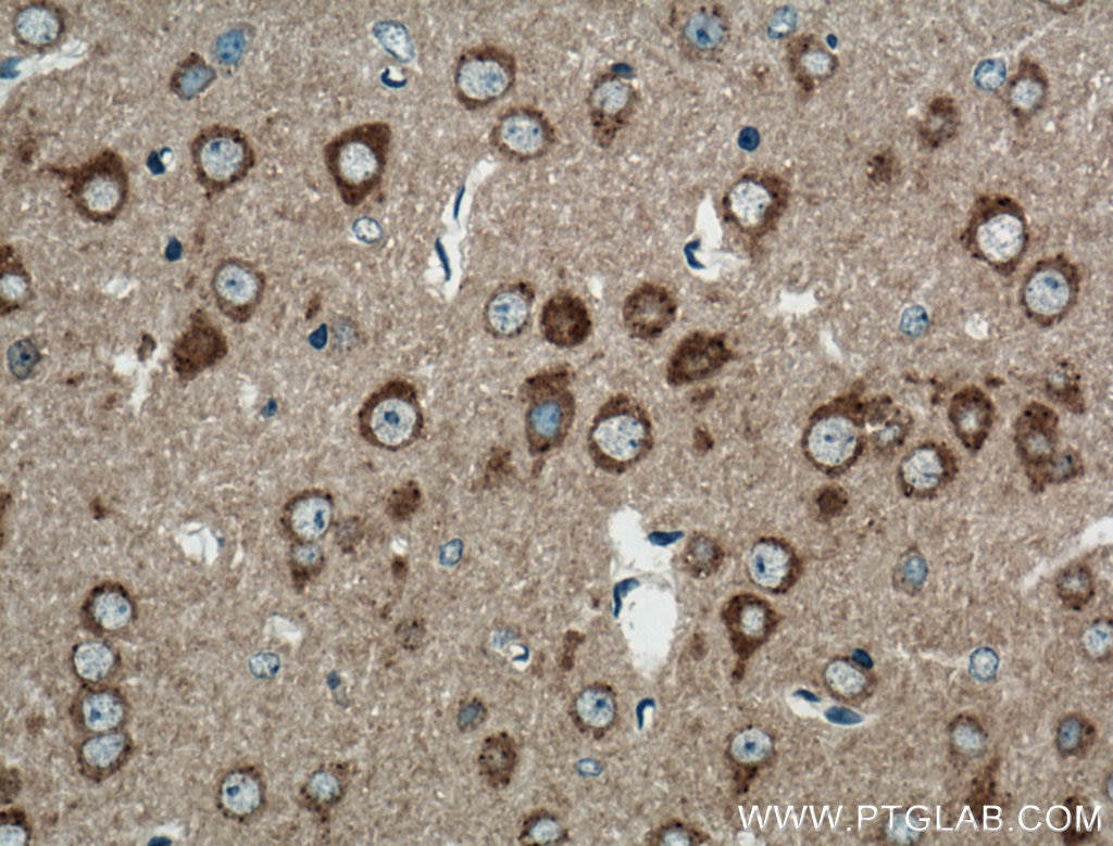 Immunohistochemistry (IHC) staining of mouse brain tissue using PRKAR1A Polyclonal antibody (20358-1-AP)