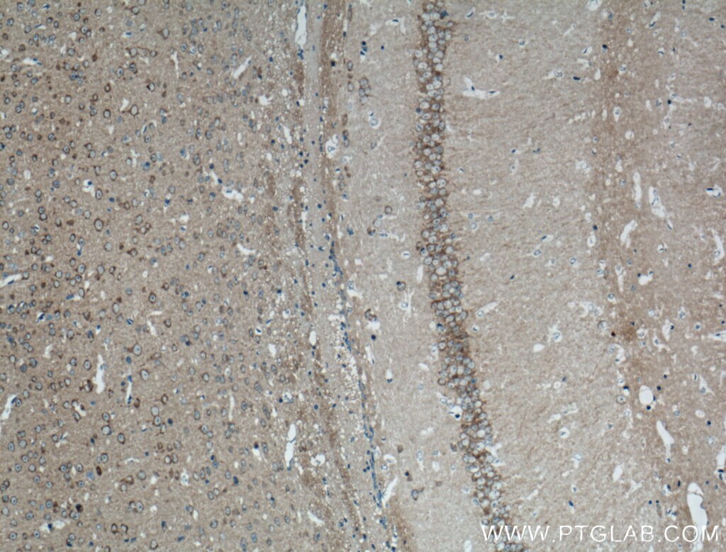 Immunohistochemistry (IHC) staining of mouse brain tissue using PRKAR1A Polyclonal antibody (20358-1-AP)