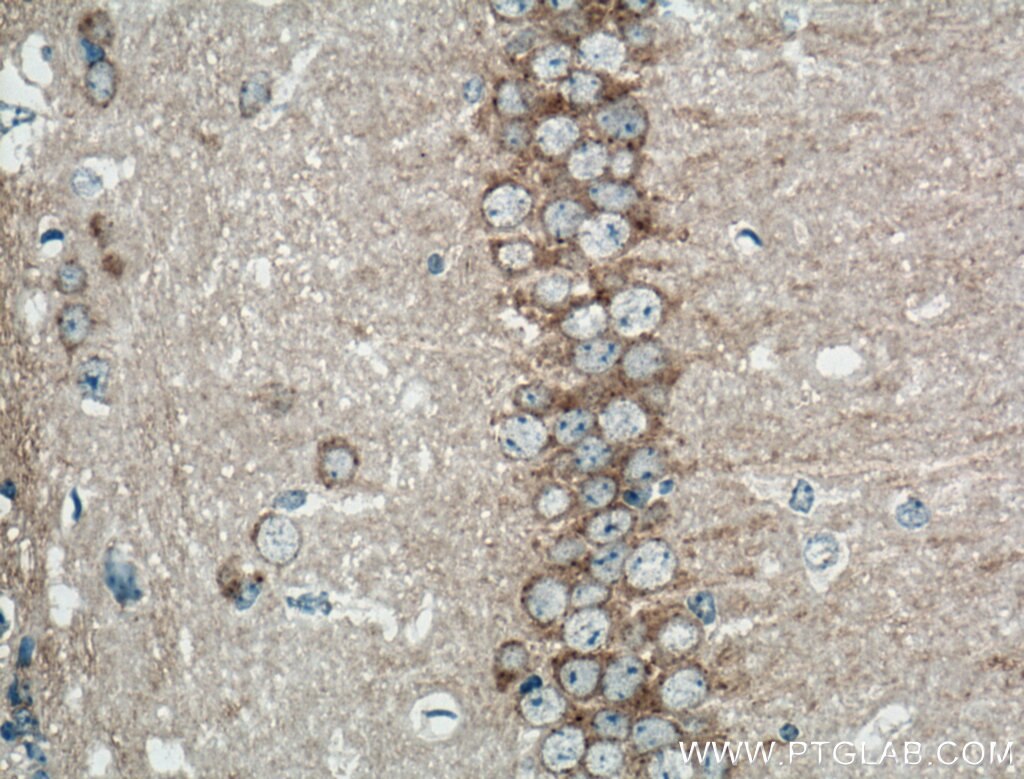 IHC staining of mouse brain using 20358-1-AP