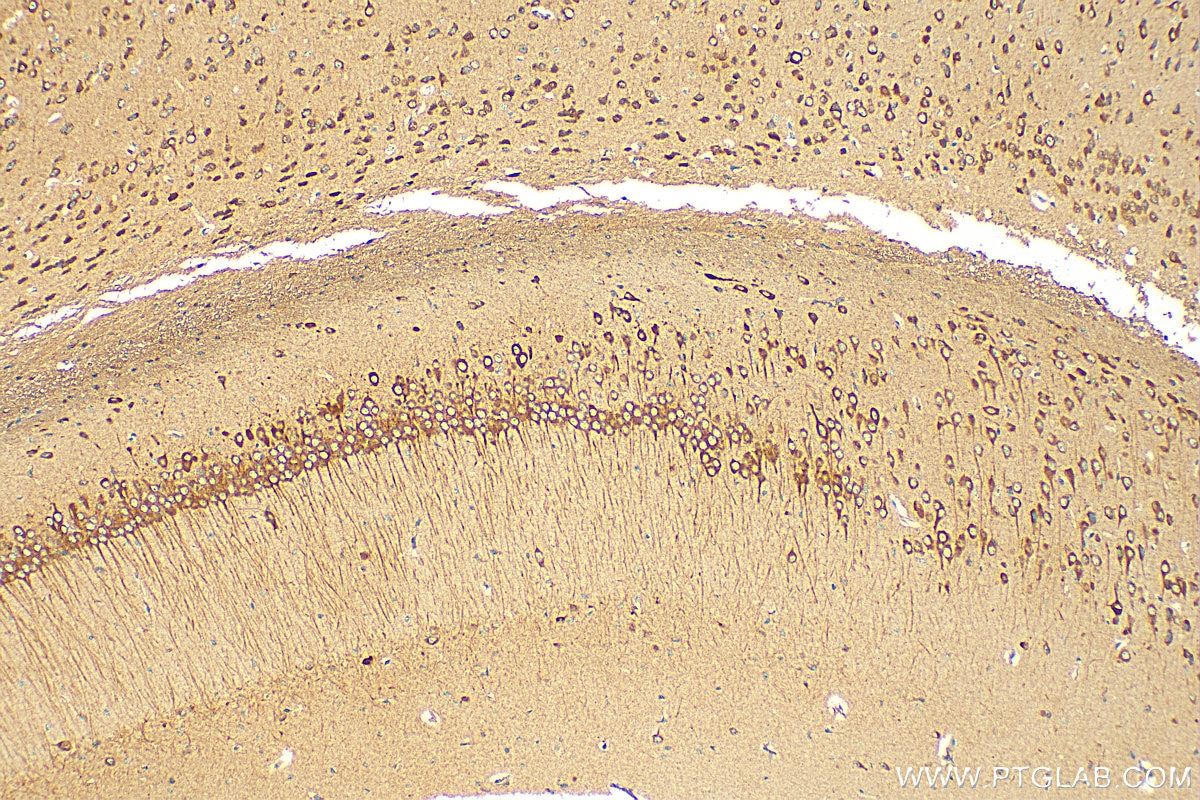 Immunohistochemistry (IHC) staining of mouse brain tissue using PRKAR1A Polyclonal antibody (20358-1-AP)