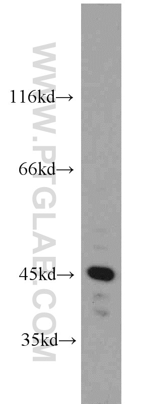 Western Blot (WB) analysis of HeLa cells using PRKAR1A Polyclonal antibody (20358-1-AP)
