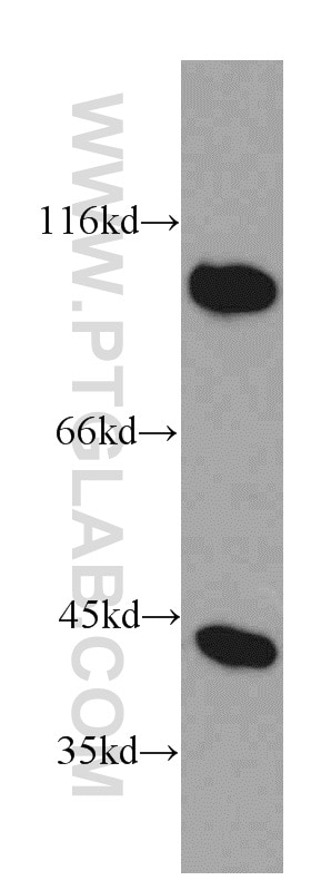 Western Blot (WB) analysis of mouse cerebellum tissue using PRKAR1A Polyclonal antibody (20358-1-AP)