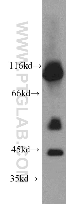 Western Blot (WB) analysis of mouse cerebellum tissue using PRKAR1A Polyclonal antibody (20358-1-AP)