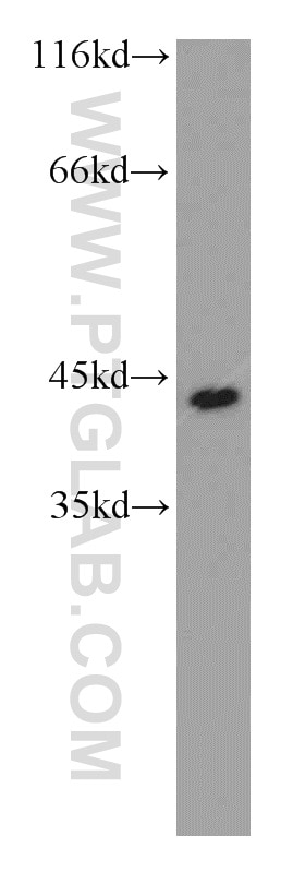 Western Blot (WB) analysis of HeLa cells using PRKAR1A Polyclonal antibody (20358-1-AP)