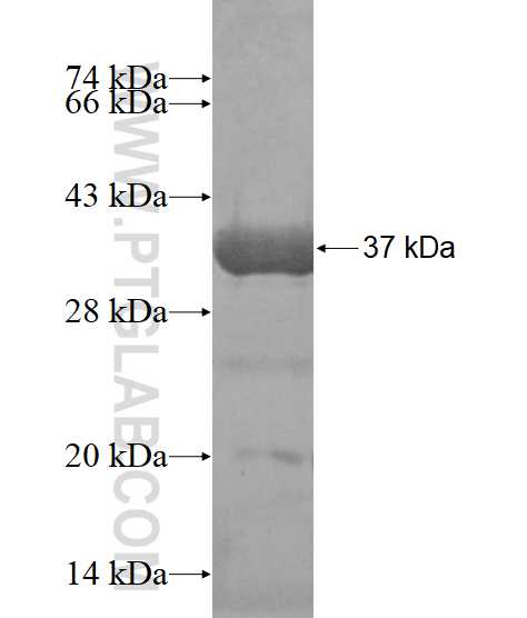PRKAR1A fusion protein Ag14216 SDS-PAGE
