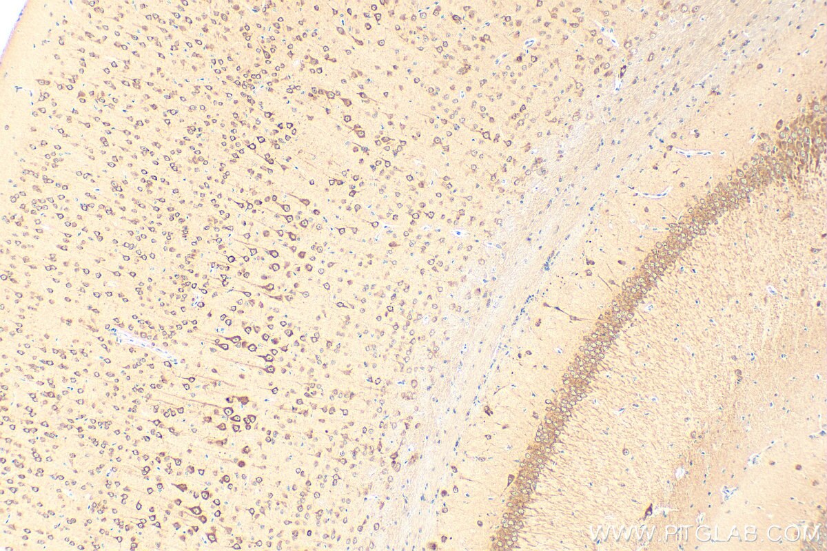 Immunohistochemistry (IHC) staining of mouse brain tissue using PRKAR1B Polyclonal antibody (17991-1-AP)