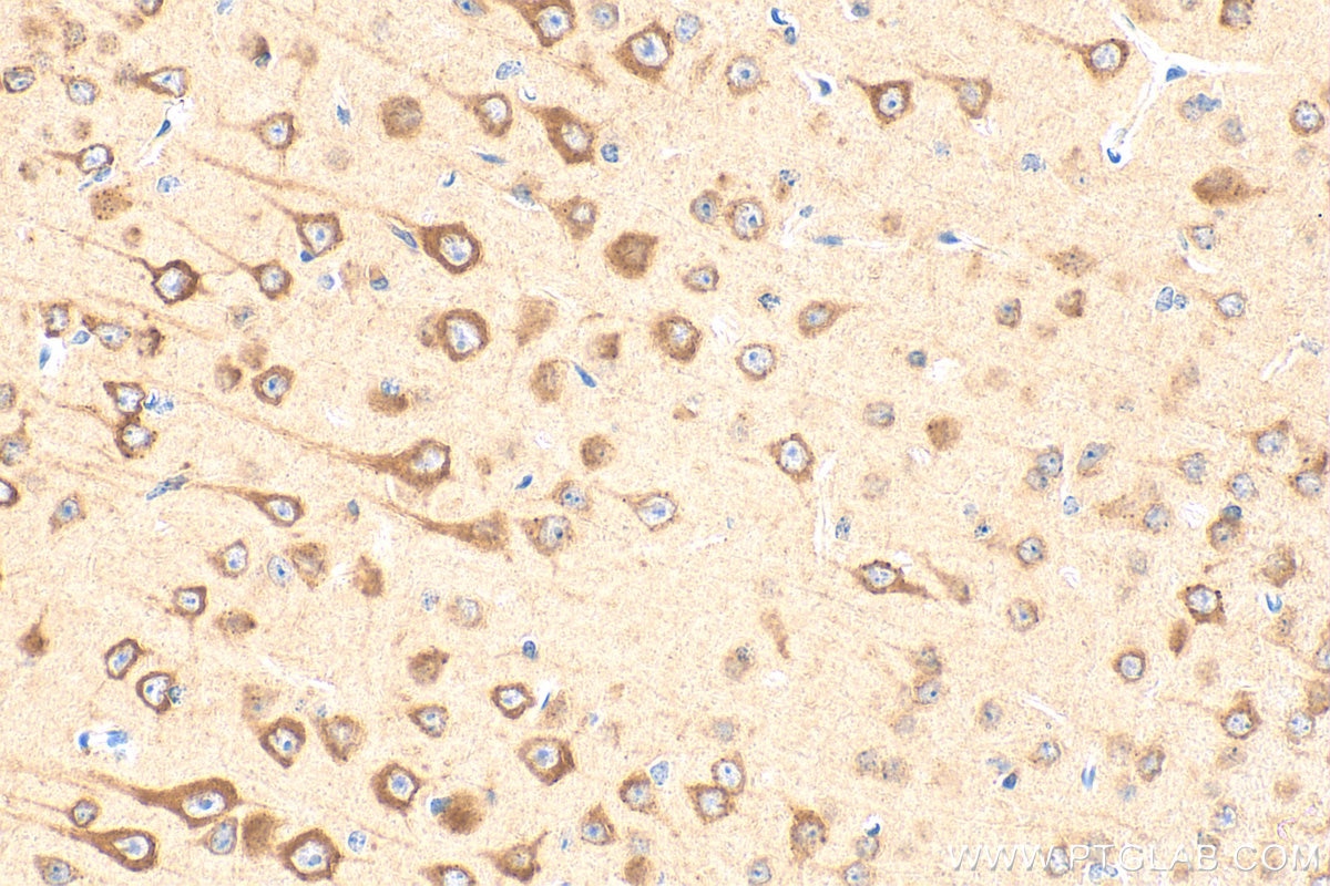 Immunohistochemistry (IHC) staining of mouse brain tissue using PRKAR1B Polyclonal antibody (17991-1-AP)
