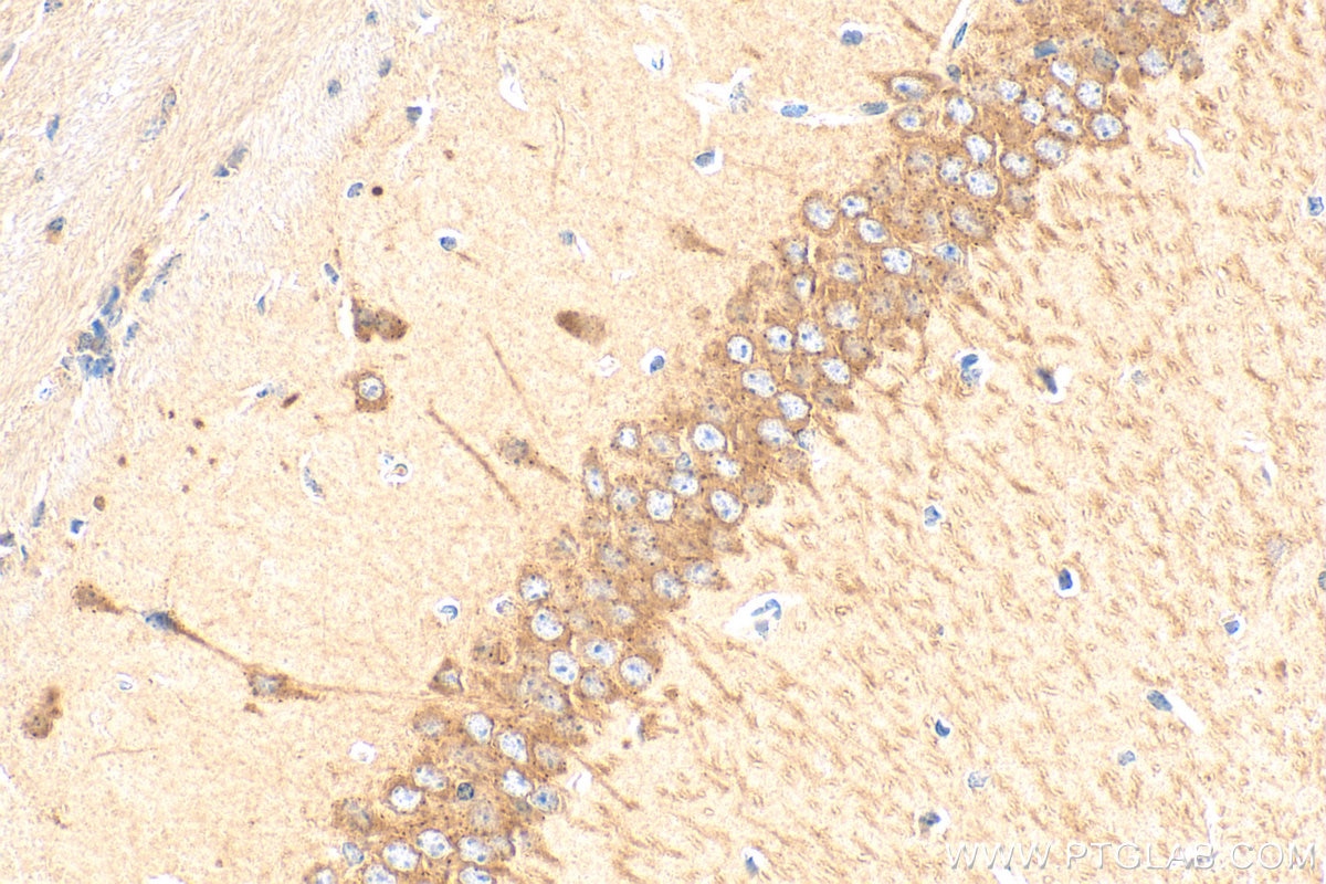Immunohistochemistry (IHC) staining of mouse brain tissue using PRKAR1B Polyclonal antibody (17991-1-AP)
