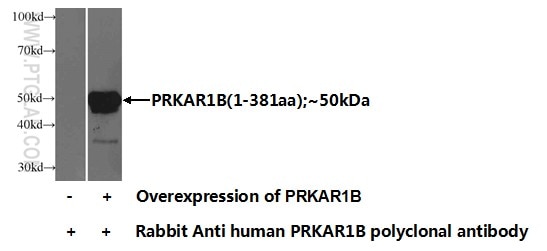 WB analysis of Transfected HEK-293 using 17991-1-AP