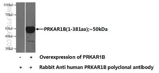 PRKAR1B