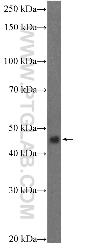 WB analysis of HeLa using 17991-1-AP