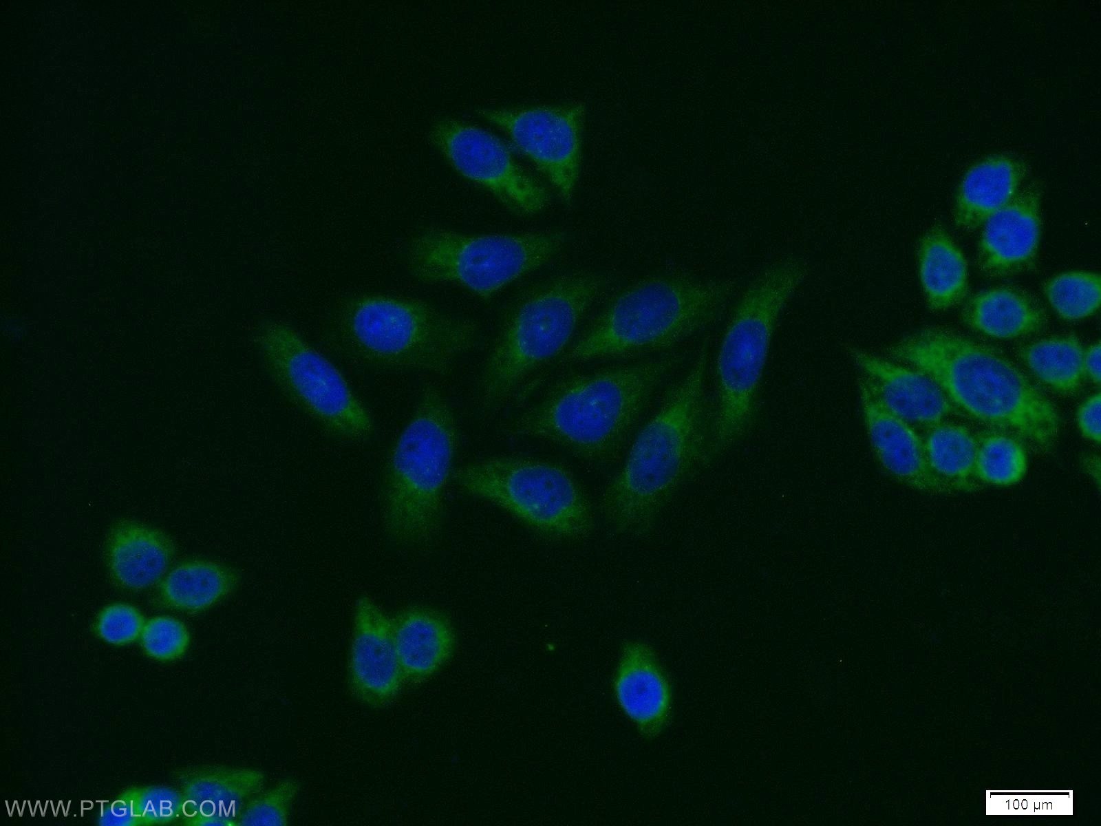 Immunofluorescence (IF) / fluorescent staining of HeLa cells using PRKAR2A Polyclonal antibody (10142-2-AP)